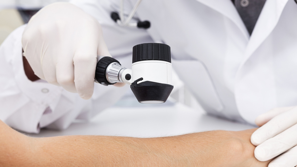 Dermatoskopi dhe hartëzim i nishaneve