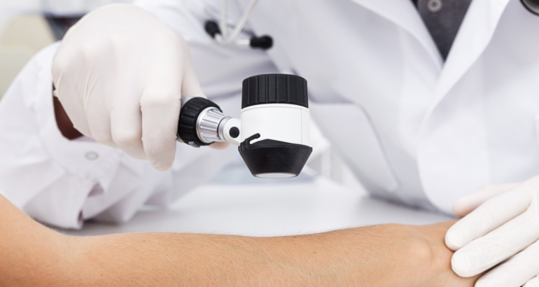 Dermatoskopi dhe hartëzim i nishaneve