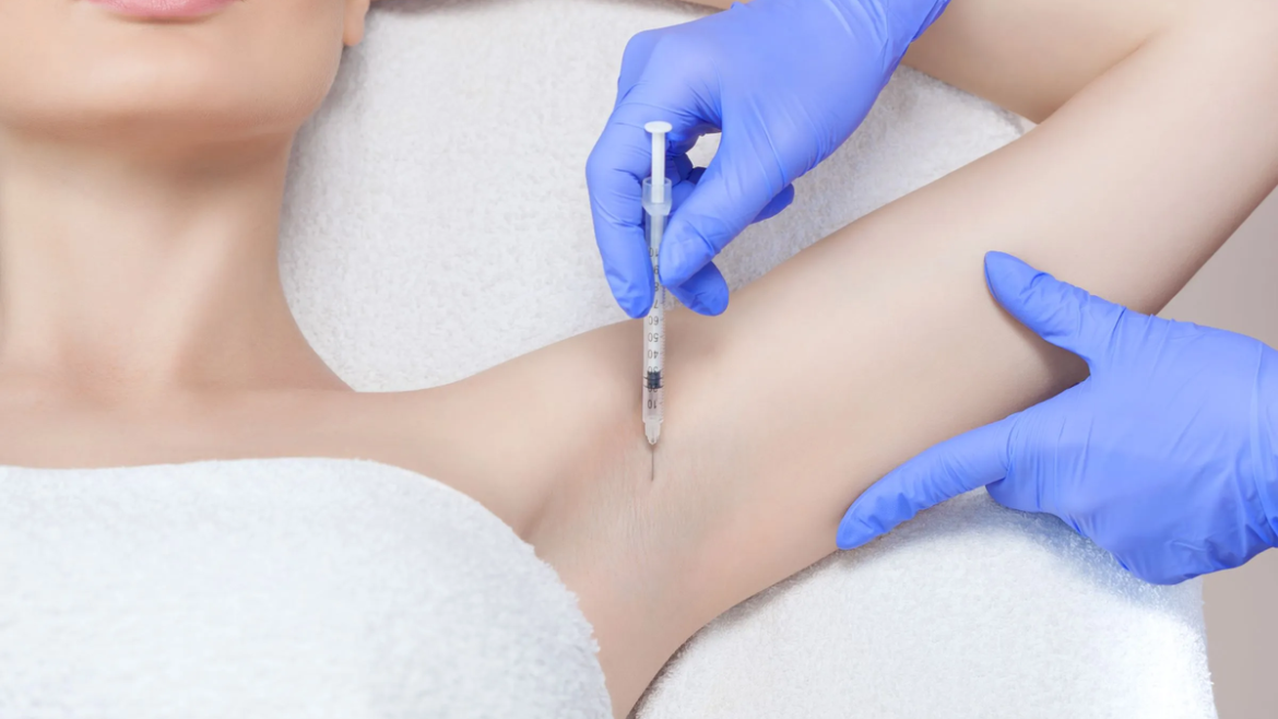 Trajtimi i djersitjes së shtuar me Botox