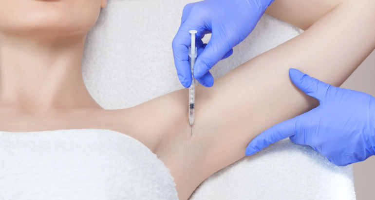 Trajtimi i djersitjes së shtuar me Botox