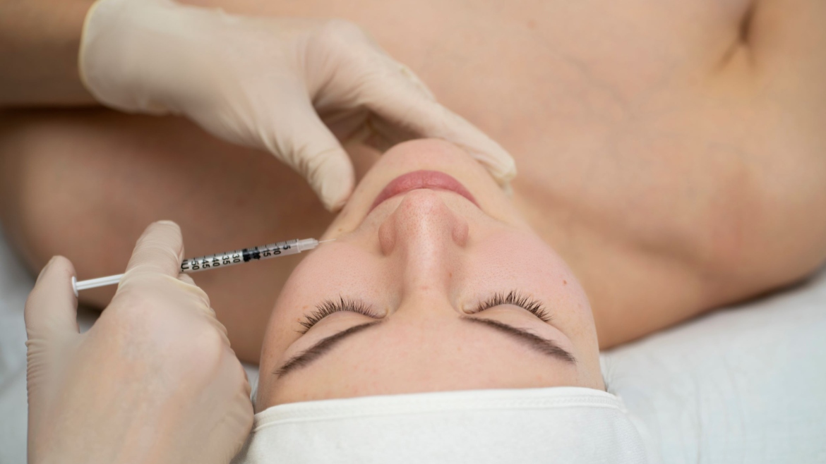 Fillerat apo acidi hialuronik