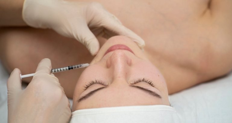 Fillerat apo acidi hialuronik