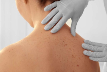 DERMATOLOGJI KLINIKE