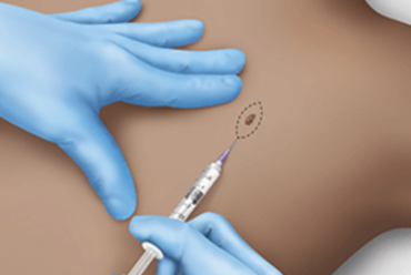 KIRURGJIA DERMATOLOGJIKE